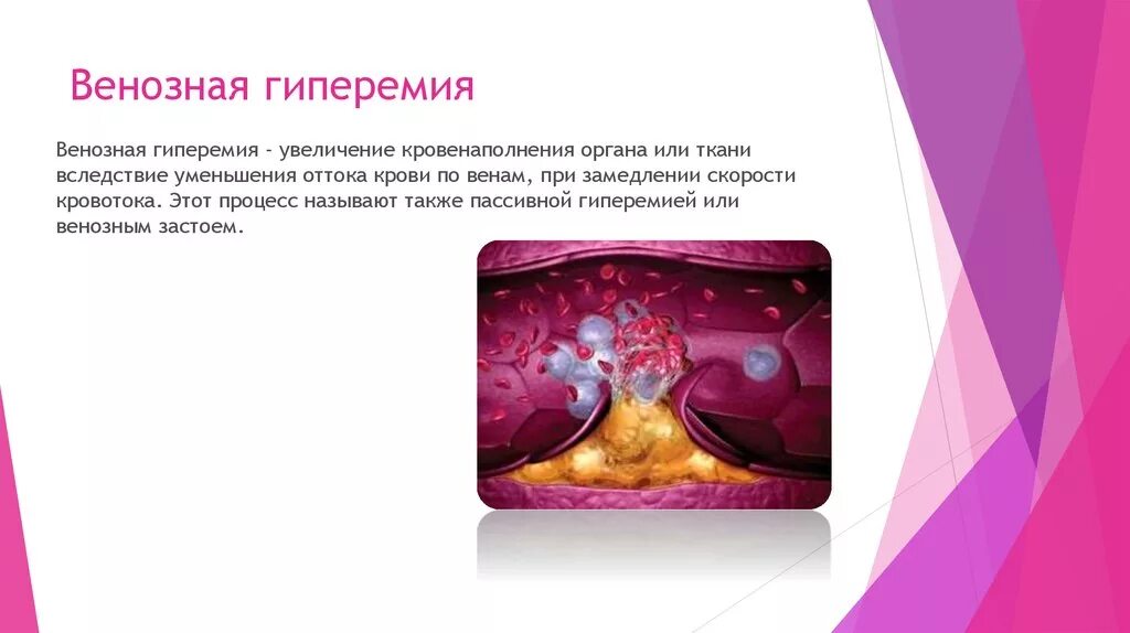 Уменьшение кровенаполнения органа