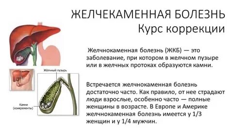 Желчекаменная болезнь отзывы