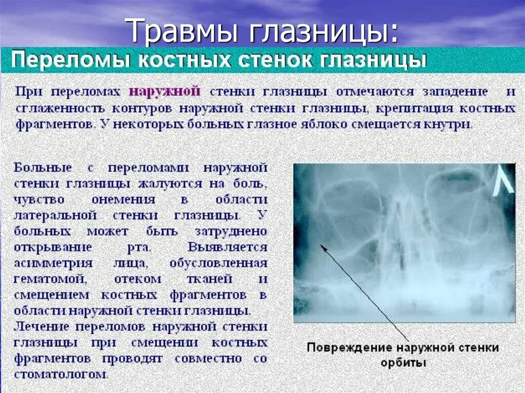 Трещина симптомы лечение. Перелом глазной орбиты. Перелом стенки глазницы.