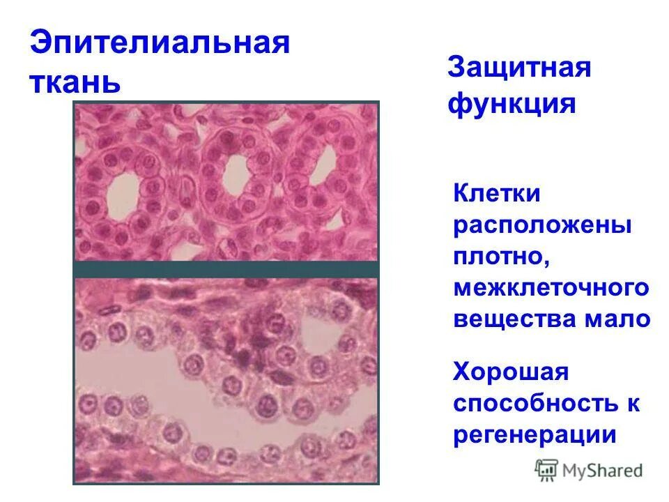 Клетки расположены плотно какая ткань. Защитная функция эпителиальной ткани. эпителиальная клетка функции. клетки защитной ткани. эпителий соединительная ткань.