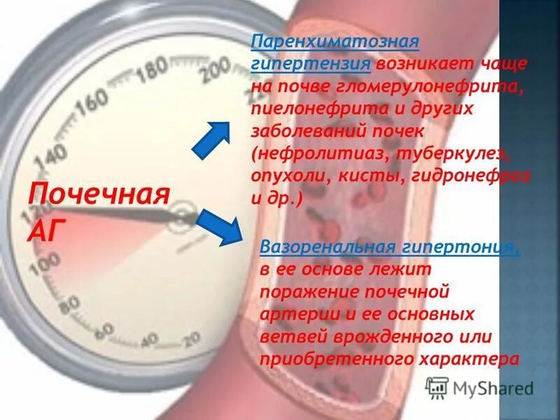 Что показывает давление. Почечное давление. Почечное артериальное давление. Взаимосвязь почек и артериального давления. Почечное давление симптомы.