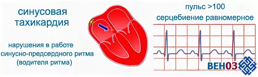 Аритмия тахикардия таблетки
