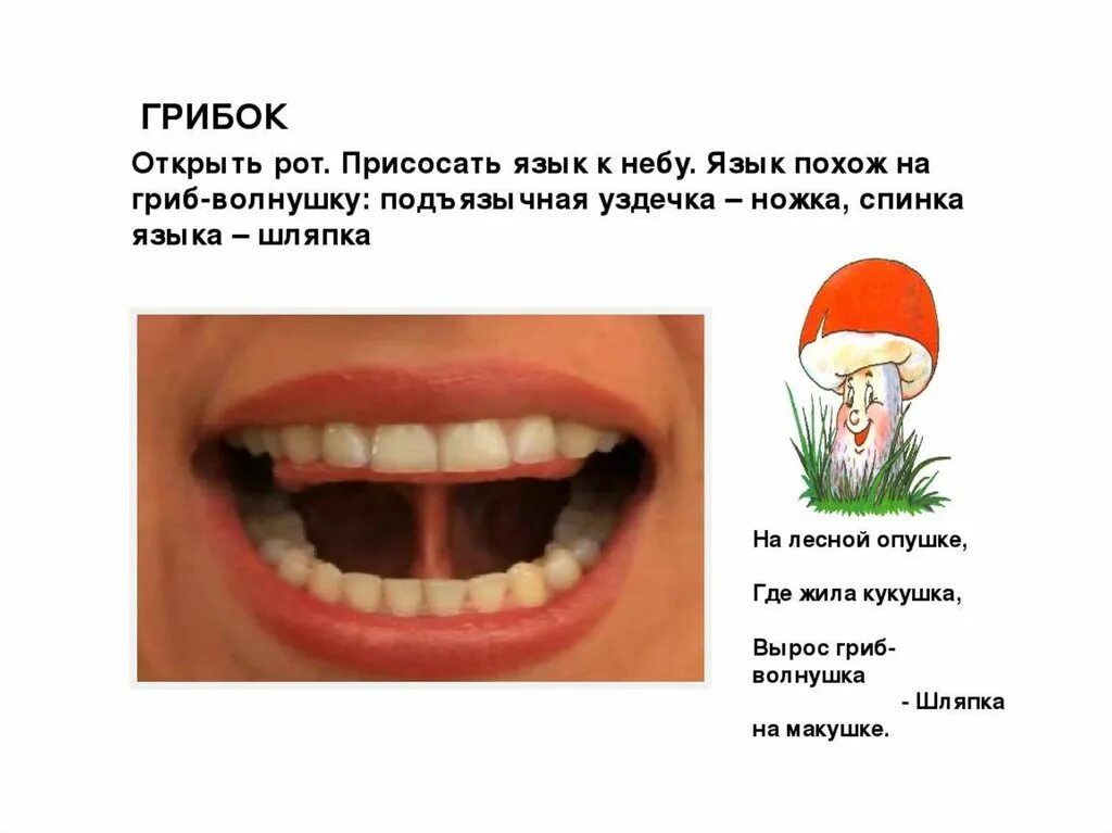 Артикуляционная гимнастика для детей грибочек. Артикуляционная гимнастика для детей грибок. Артикуляционная гимнастика гриб. Упражнение грибок артикуляционная гимнастика. Грибок логопедия.