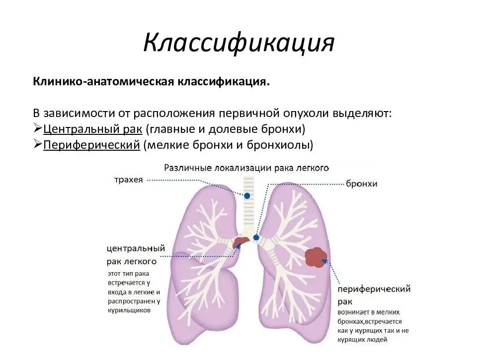 Стадии рака бронха. Уентральныйрак легкого. Периферический очаг легкого. Центральная опухоль легкого. Опухоли бронхов и легких.