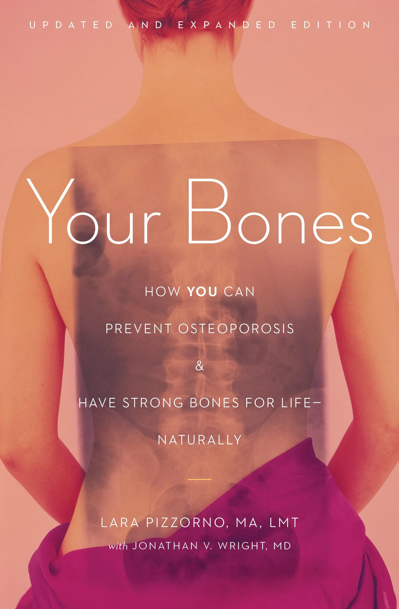 Bones how