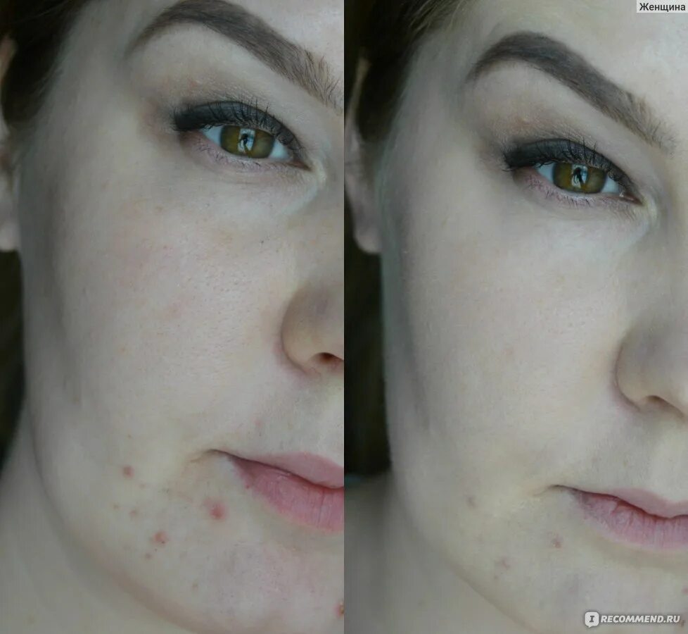 Окисляется тональный крем. Тональник окисляется. Окисление тональника. Тональный крем окисляется на коже. Тональный крем окисляется на лице.