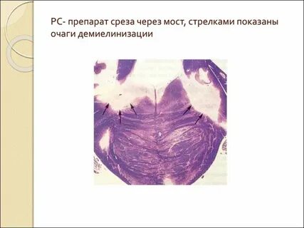 Срезам препарат