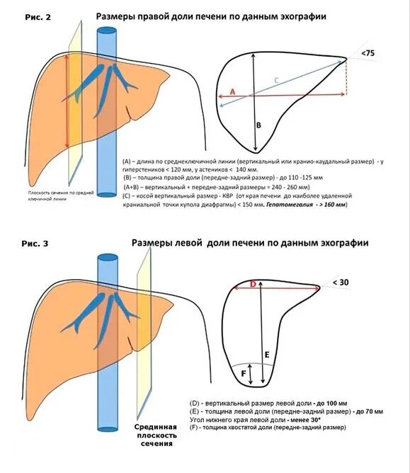 Квр печени увеличена. Толщина левой доли печени норма. Переднезадний размер левой доли печени. Толщина правой доли печени в норме. Норма размера право доли печени.