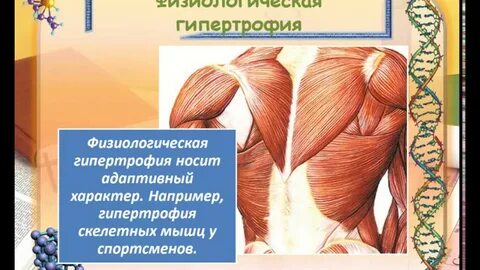 Рабочая гипертрофия
