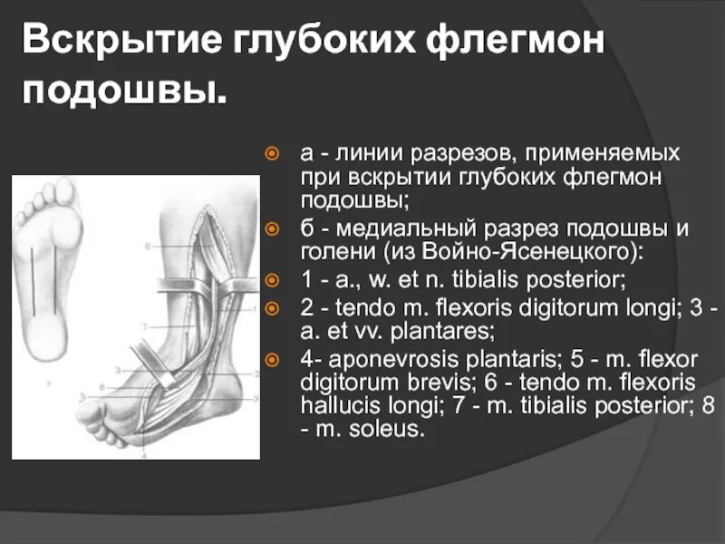 Линии разрезов при вскрытии флегмон предплечья. Вскрытие подапоневротической флегмоны подошвы по войно ясенецкому. вскрытие флегмон подошвы. разрезы при флегмонах стопы. разрезы для вскрытия глубоких флегмон голени.