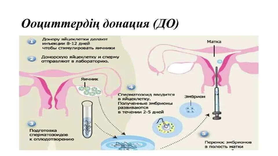 Экстракорпоральное оплодотворение. Донация ооцитов. Искусственное оплодотворение женщины. Эко с донорской яйцеклеткой. Женщины доноры яйцеклеток