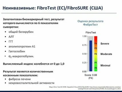 Фибротест