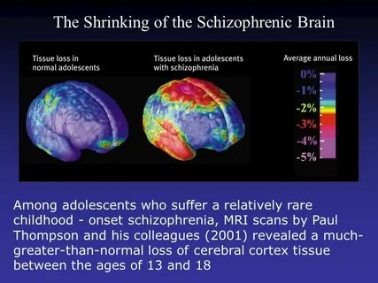 Schizophrenia slowed