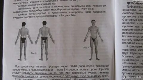 Алмаг куда прикладывать