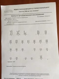 Анализ на хромосомы