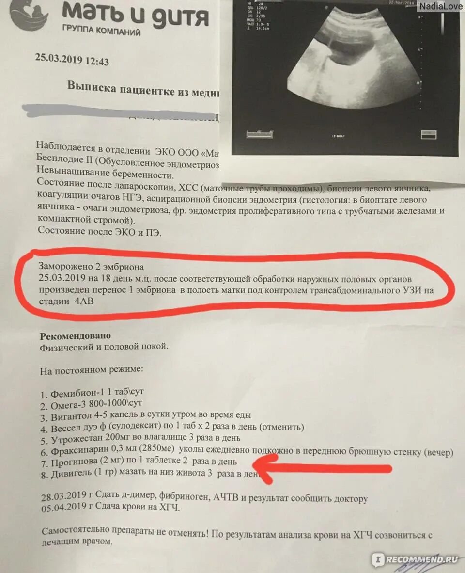 Сроки криопереноса. Протокол переноса эмбрионов. Препараты перед подсадкой эмбрионов. Выписка после эко. После подсадки эмбриона.