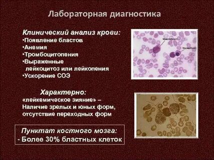 Тромбоцитопения анемия