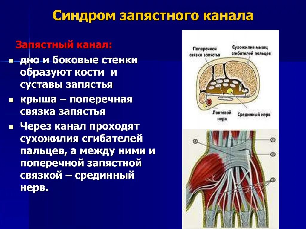 Каналы запястья топографическая анатомия. Запястный туннельный синдром. Синдром канала запястья. Синдром запястного канала (карпальный туннельный синдром). После операции запястного канала