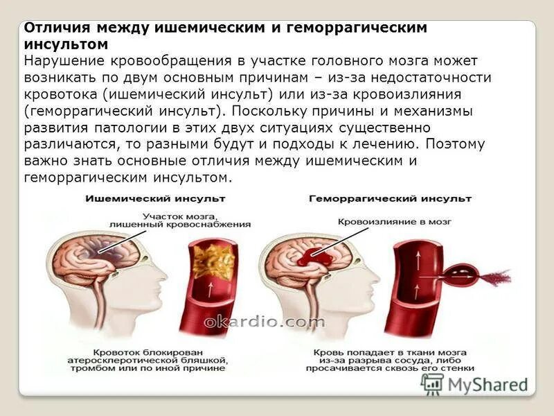 Общемозговые симптомы при геморрагическом инсульте. Ишемический инсульт поражения артерий. Инсульт геморрагический разрыв сосуда и кровоизлияние. Ишемический и геморрагический инсульт.