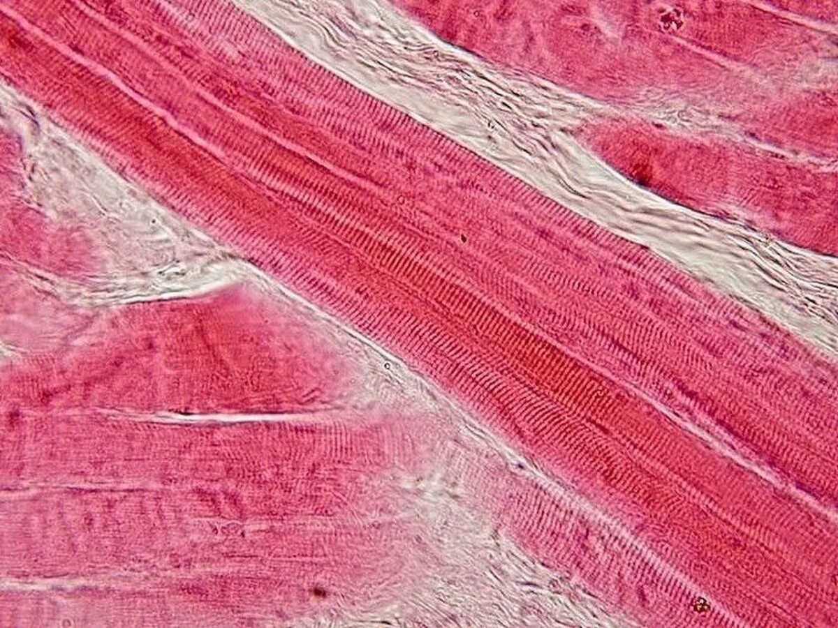 Гладкие мышцы многоядерные. Скелетная мышечная ткань микропрепарат. Поперечно Скелетная мышечная ткань. Скелетная мышца микропрепарат. Микропрепарат скелетной поперечно полосатой мышечной ткани.