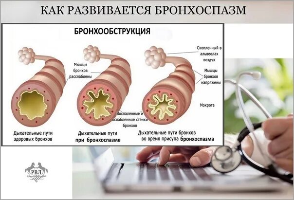 Скрытый бронхоспазм. Бронхоспазм при аллергии. парадоксальный бронхоспазм.