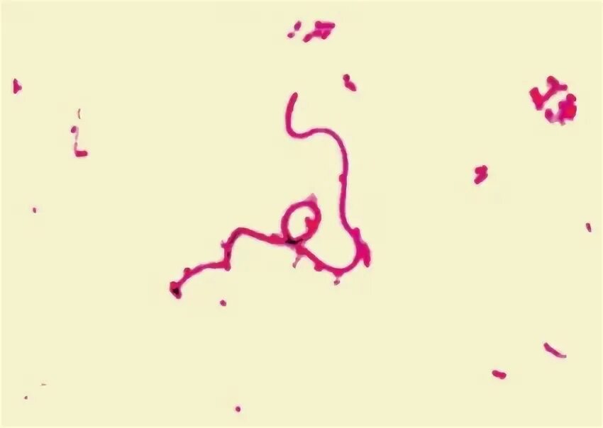 Sneathia spp. Fusobacterium nucleatum морфология. fusobacterium spp микроскопия. fusobacterium necrophorum морфология.