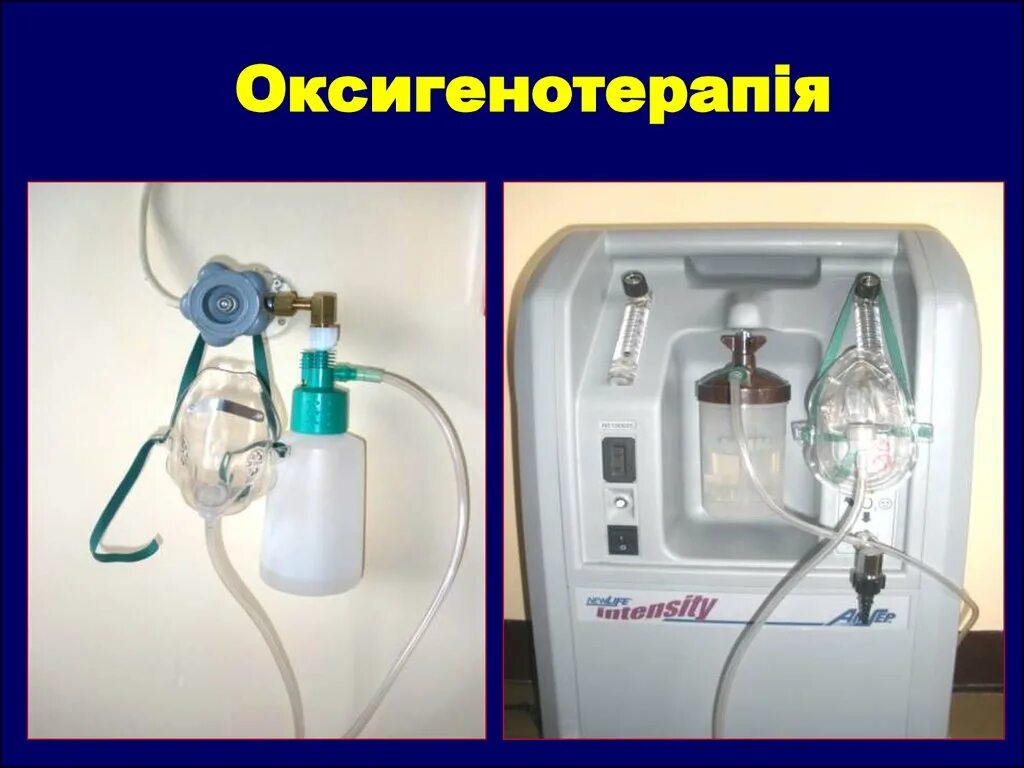 Алгоритм подачи кислорода через. Аппарат Боброва для оксигенотерапии. Кислородотерапия аппаратом Боброва. Аппарат Боброва пеногасители. Оксигенотерапия прибор.