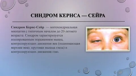 Синдром барбера сея