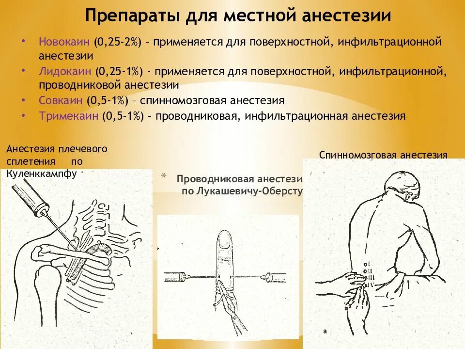 Проводниковая анестезия Оберста Лукашевича. Оснащение для анестезии по Оберсту-Лукашевичу. Проводниковая анестезия пальца по Лукашевичу-Оберсту. Анестезия метод Оберсту Лукашевичу. Что такое проводниковая анестезия