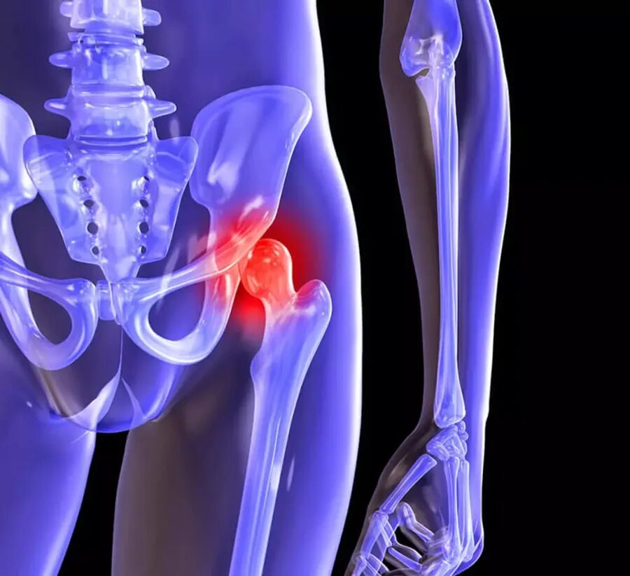 Полиартрит тазобедренного сустава. Суставы красиво. Синовит локтевого сустава. Суставы. Суставы картинки.