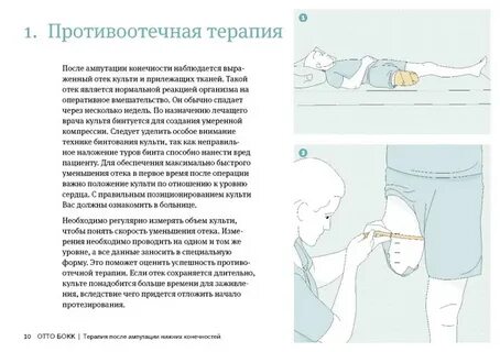 Ампутация нижней конечности мкб 10 код