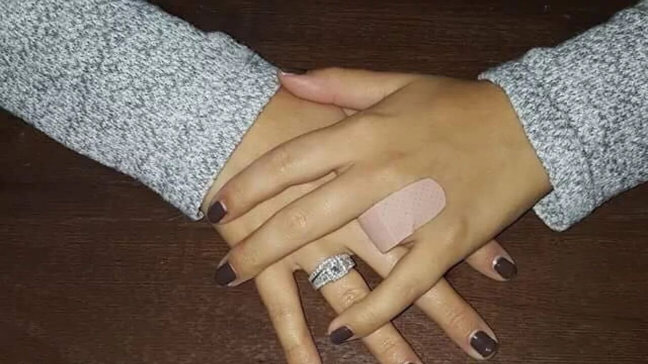 девушка без пальцев рук