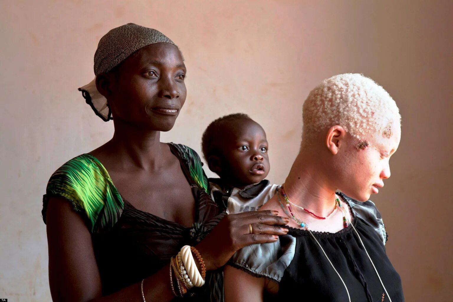 К чему снятся негры. Альбиносы африканцы Танзания. Африканские дети альбиносы.