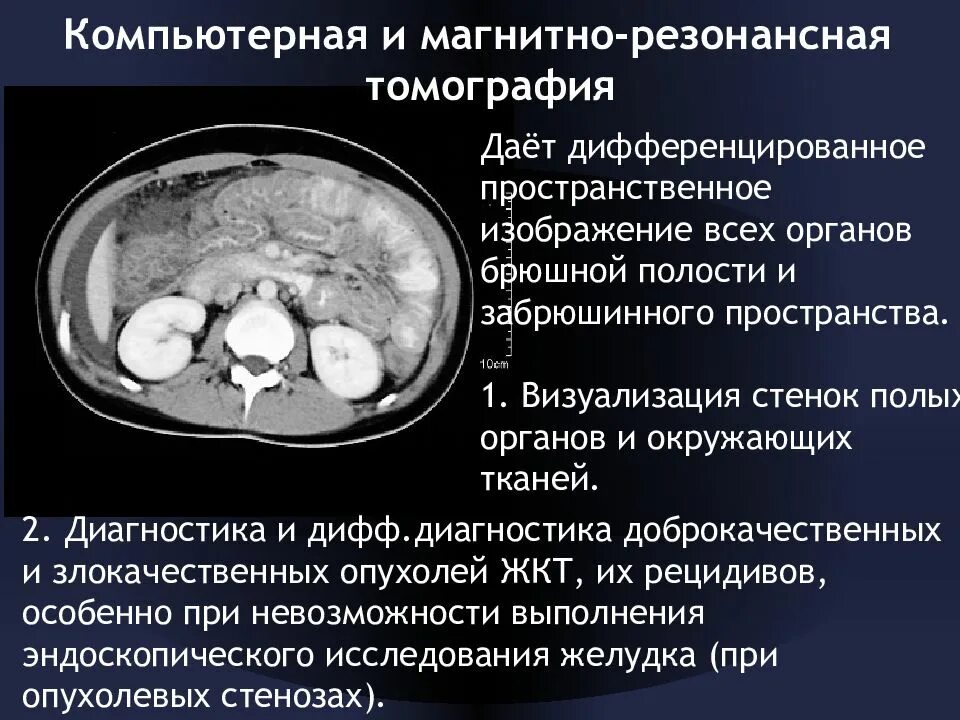 Компьютерная томография органов брюшной полости. Кт брюшной полости и забрюшинного пространства. Кт или мрт брюшной полости. Мрт органов брюшной полости и забрюшинного пространства.