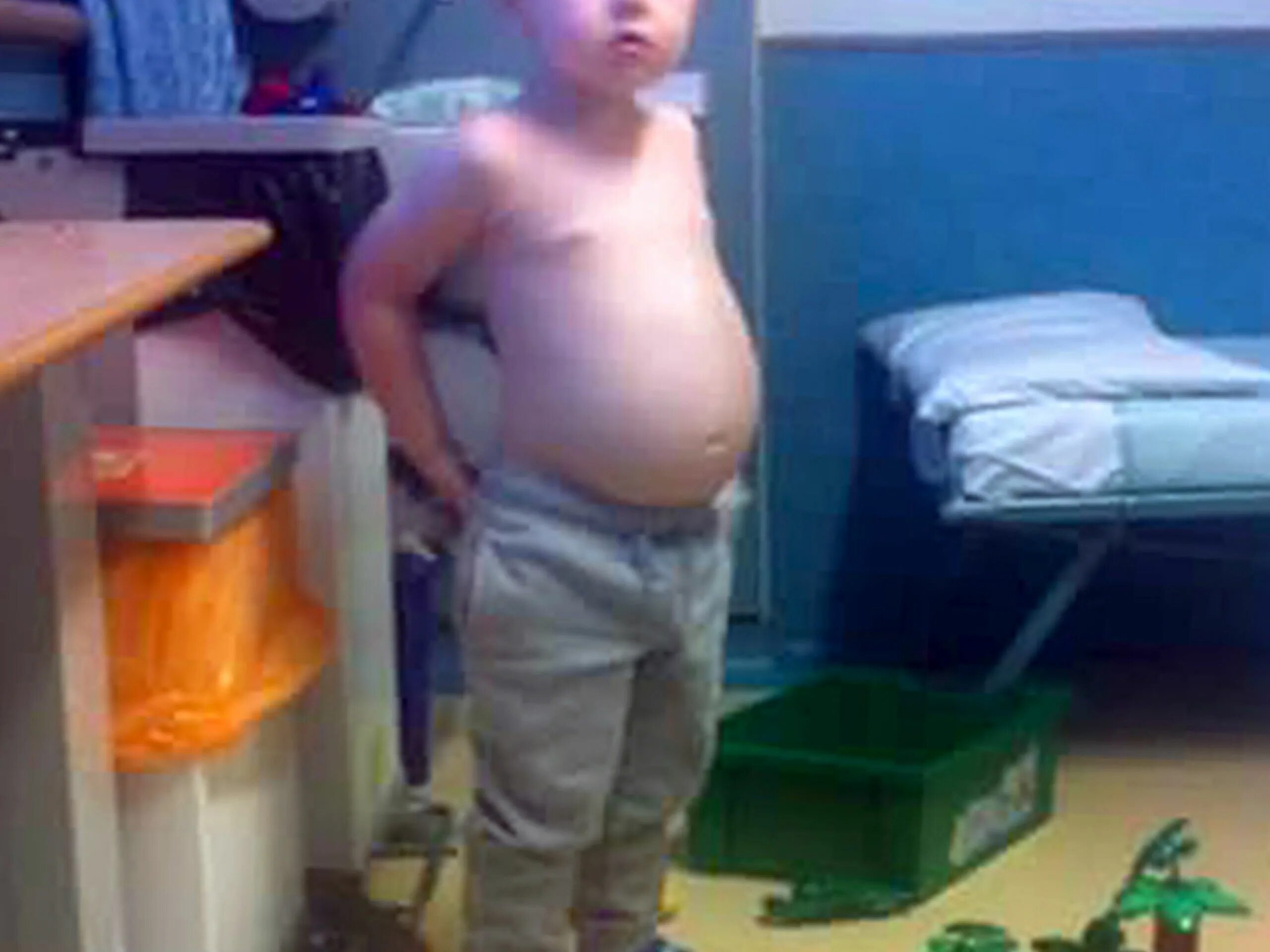 почему у детей большой живот. дети с большим животиком. почему у детей большой живот. почему у детей большой живот. лягушечий живот у грудничка.