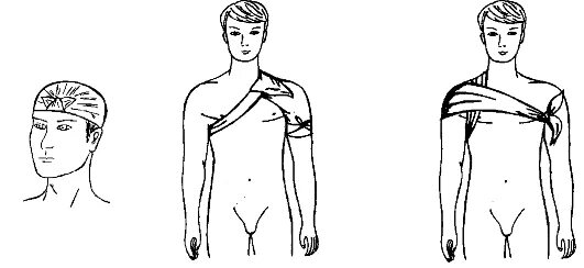 Техника наложения повязки на плечо. Косыночная повязка техника наложения. Десмургия Косыночная повязка. Косыночная повязка на промежность. Косыночная повязка на плечевой сустав.