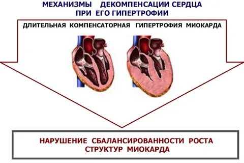 Сердечная декомпенсация