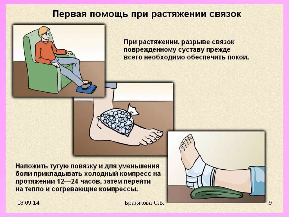 Первая при растяжении связок. Оказание первой помощи при растяжении связок. Оказание первой помощи при растяжении и разрыве связок. Первая доврачебная помощь при растяжении связок. При растяжении связок для оказания первой помощи рекомендуется.