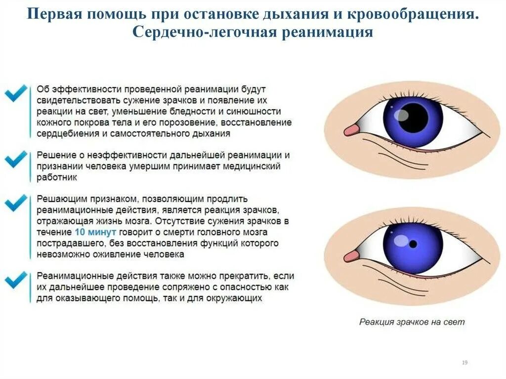 Практическая работа сужение и расширение зрачка биология. Оценка реакции зрачков на свет. Реакция зрачка пострадавшего на свет свидетельствует. Суженные зрачки признак. Сужение зрачков у пострадавшего.