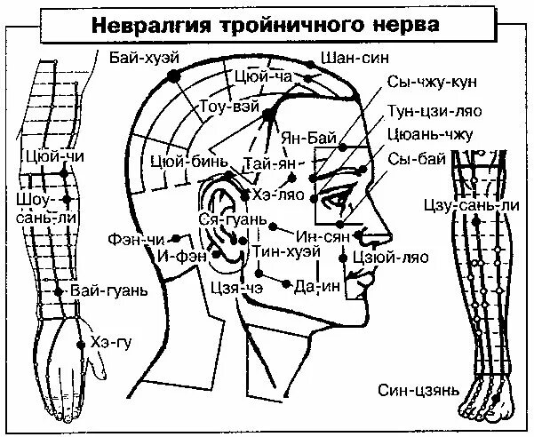 Иглоукалывание при неврите. Акупунктура при неврите лицевого нерва. точечный массаж при невралгии тройничного нерва. невралгия тройничного нерва акупунктура. иглотерапия при тройничном нерве.