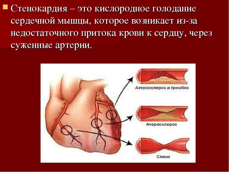 В сердечной мышце развивается