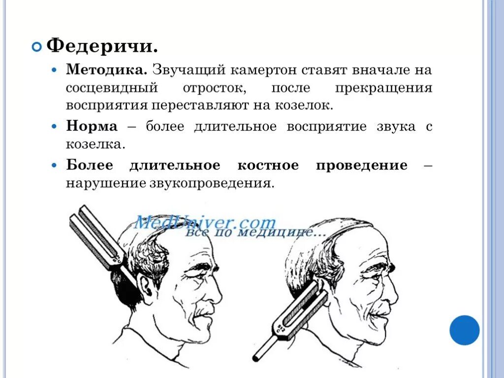 Исследование слуха камертонами. Метод исследования слуха камертонами. Метод исследованияслуха комертоном. Опыт Федеричи исследование слуха.