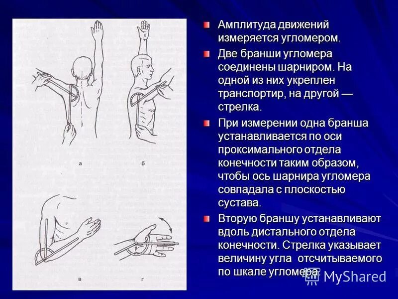 Ограничение количества и объема движений это. Амплитуда движения измеряется в. измерение амплитуды движений в суставах. амплитуда и объем движений в суставах. измерение движений в суставах верхней конечности.