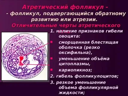 Фолликулярный фолликул