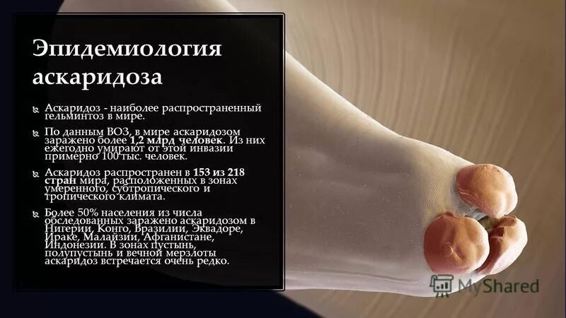 Код мкб аскаридоз. Код мкб аскаридоз