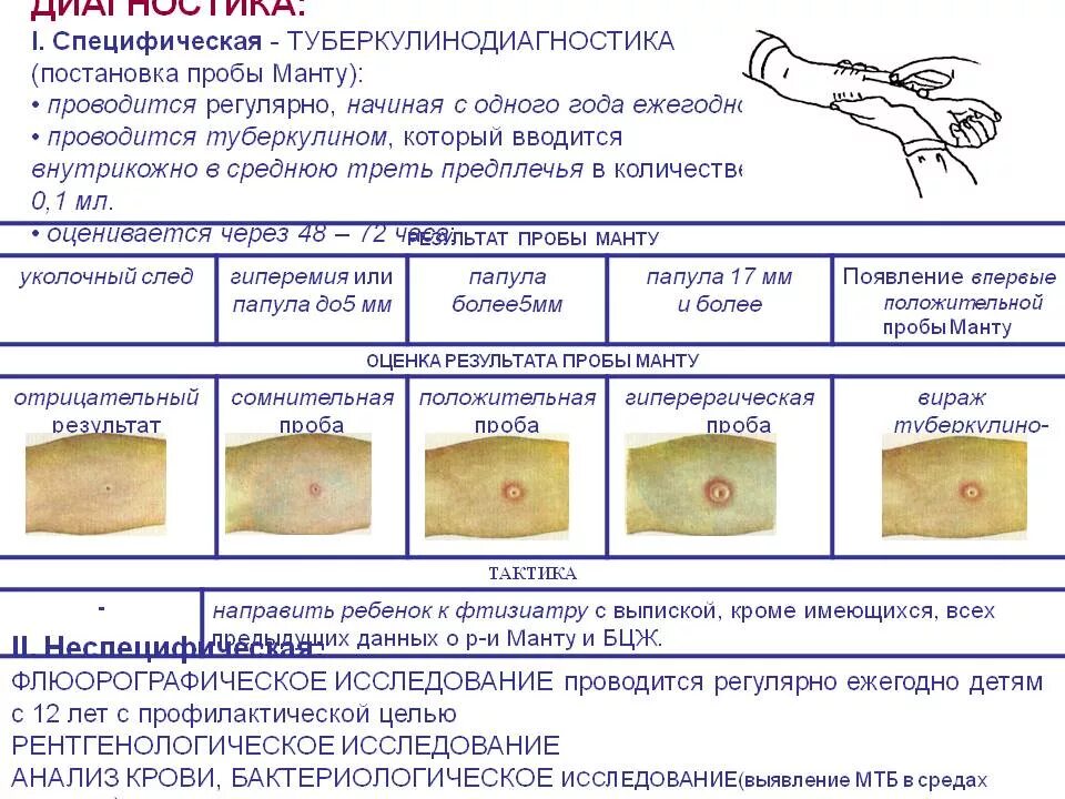 Специфические пробы. Реакция манту норма размера папулы в год. Расшифровка реакции манту у ребенка 1 годик. Как выглядит нормальная реакция на манту у ребенка в 5 лет. Ложноположительная реакция манту у ребенка 1год.