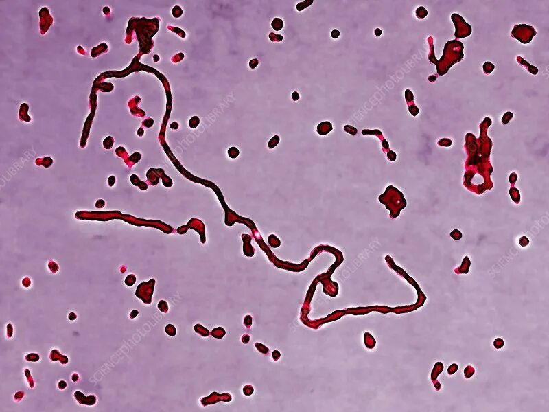 Streptococcus pneumoniae haemophilus influenzae streptococcus. Бактерии haemophilus influenzae. haemophilus influenzae микробиология. палочка пфейфера в мокроте. haemophilus influenzae под микроскопом.