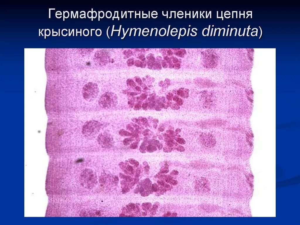 Гермафродитный членик это. Крысиный цепень микроскоп. крысиный цепень hymenolepis diminuta. карликовый цепень зрелый членик. гермафродитный членик карликового цепня.