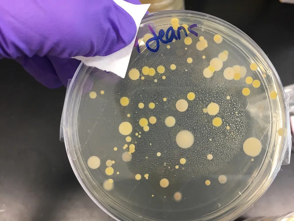 кандида на чашке петри. синегнойная палочка в чашке петри. посев бактерий. посев микроорганизмов на питательные среды. питательные среды для культивирования бактерий.