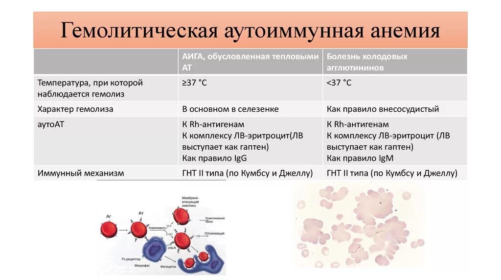 Распад крови. Гемолиз при аутоиммунная гемолитическая анемия. Гемолитическая анемия лейкоцитарная формула. Аутоиммунная гемолитическая анемия картина крови. Иммунный гемолиз эритроцитов.